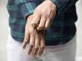 Uomo con camicia a quadri che si gratta il polso, soffrendo di prurito in tutto il corpo.