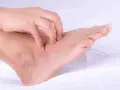 Una mano se rasca la piel escamosa y enrojecida de un pie, mostrando los efectos de la psoriasis en los pies.