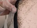 Guante de látex revisa manchas de chinches en el colchon, evidencia de una infestación.