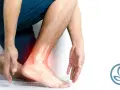 Un uomo si tiene la caviglia, evidenziata in rosso, con un'immagine scheletrica che mostra **piedi doloranti dopo camminata**.