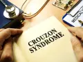 Książka z napisem "CROUZON SYNDROME", stetoskop, dokument "MEDICAL HISTO" i lekarstwa.
