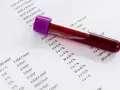 Probówka z krwią na tle wyników badań. Różne normy laboratoryjne mogą wynikać z metod pomiarowych i specyfiki analiz.