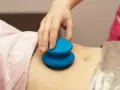 Dłoń terapeuty wykonuje masaż banką chińską na brzuchu pacjentki.