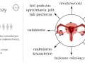 Objawy endometriozy: ból podczas owulacji, niestrawność, bezpłodność, mdłości, bolesny stosunek, bolesne miesiączki, nadmierne krwawienie, osłabienie, ból podczas opróżniania jelit lub pęcherza.