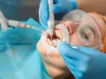 Profesjonalna higienizacja zębów. Dentysta ultradźwiękami usuwa kamień, dbając o zdrowy uśmiech pacjenta.