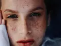 Nahaufnahme eines Gesichts mit vielen Sommersprossen oder Altersflecken, die sich über Wangen und Nase verteilen.