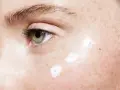 Nahaufnahme eines Auges mit Sommersprossen und drei Tupfern weißer Creme, die auf die Haut aufgetragen werden. Mögliche Ursachen für feuchte Haut.