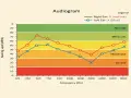 Audiogram montrant la formule décibel pour l'oreille droite (rouge) et gauche (bleu), indiquant différents niveaux de perte auditive.
