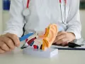 Lekarz pokazuje model ucha, wskazując na potencjalną białą wydzielinę w uchu.