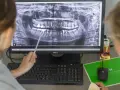 Górna dwójka: Jeden kanał to norma? Sprawdź, co mówi dentysta