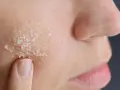 Dito, un dito applica un peeling acido glicolico a casa, con cristalli visibili sulla pelle.