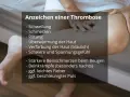 Anzeichen einer Thrombose: Schwellung, Schmerzen, Rötung, Überwärmung, Verfärbung, Spannungsgefühl, Beinschmerzen, Krämpfe, Fieber, Puls.