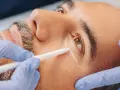 Man receiving treatment to eliminate dark circles permanently. A gloved hand holds a device near his eye.