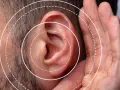 Gros plan sur une oreille humaine avec des cercles concentriques symbolisant le son. Une main est placée près de l'oreille, suggérant une gêne ou une irritation oreille boule quies.