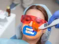 Kobieta przechodzi zabieg wybielania zębów u dentysty. Specjalista używa lampy aktywującej żel wybielający.