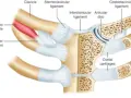 Anatomia stawu mostkowo obojczykowego: obojczyk, mięsień podobojczykowy, więzadła i krążek stawowy.