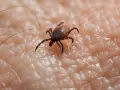 Garrapata en piel humana, un ejemplo de los tipos de garrapatas en España.