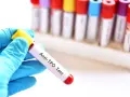 Ręka w niebieskiej rękawiczce trzyma probówkę z krwią do badań immunologicznych u dzieci. Test Anti-TPO.