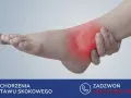 Ból w stawie skokowym, zaczerwienienie i obrzęk wskazują na problem z więzadłem ATFL. Skontaktuj się po pomoc.