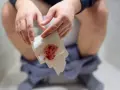 Dłoń trzymająca papier toaletowy z krwią, sugerującą niepokojący metaliczny zapach kału.