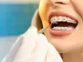 Zbliżenie na usta kobiety z aparatem ortodontycznym, badane przez dentystę.