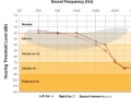 Graphique audiogramme montrant les seuils auditifs. On entend à partir de 0 dB. Les zones orange indiquent une perte auditive.