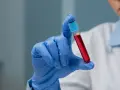 Ręka w niebieskiej rękawiczce trzyma probówkę z czerwoną cieczą. To może być próbka do badań, np. PDW co to jest, czyli wskaźnik anizocytozy płytek krwi.