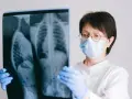 Rehabilitacja NFZ Wrocław: Znajdź termin "na cito" i omiń kolejki!