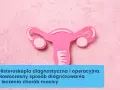 Różowa grafika macicy z jajowodami. Histeroskopia diagnostyczna i operacyjna to nowoczesny sposób diagnozowania i leczenia chorób macicy.