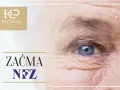 Zaćma: NFZ czy prywatnie? Gdzie najlepiej operować? Poradnik
