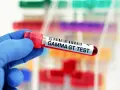 Ręka w niebieskiej rękawiczce trzyma probówkę z krwią oznaczoną "GAMMA GT TEST". To badanie ocenia poziom enzymu gamma-glutamylotranspeptydazy.