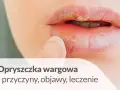 Zbliżenie na usta z widoczną opryszczką wargową w różnych fazach. Palec wskazujący dotyka dolnej wargi.