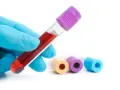 Ręka w niebieskiej rękawiczce trzyma probówkę z krwią do badania, np. hba1c. W tle inne probówki.