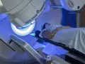 Pacjentka leży na stole zabiegowym pod aparatem do radioterapii, na jej ciele widoczne są zielone linie naprowadzające.