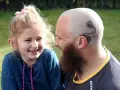 Uśmiechnięta dziewczynka i mężczyzna z tatuażem implantu ślimakowego na głowie. Rozmowa o implancie ślimakowym za i przeciw.