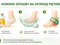 Domowe sposoby na ostrogę piętową: okład z octu jabłkowego, kąpiel z sodą, krioterapia. Pomagają złagodzić ból pięty.