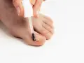 Application d'une huile essentielle sur un ongle incarné pour soulager la douleur et favoriser la guérison.