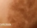 Piel con manchas irregulares, indicativo de hiperpigmentación postinflamatoria.