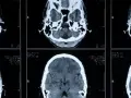 Die Bedeutung der medizinischen Diagnostik für präzise Krankheitsdiagnosen