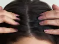 Hände untersuchen dunkles Haar und die Kopfhaut, die fettig aussieht.