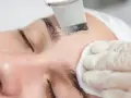Peeling kawitacyjny usuwa zaskórniki, pozostawiając skórę gładką. Efekty widoczne od razu!