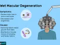 Illustrazione sulla degenerazione maculare umida, con sintomi e cause. Un occhio stilizzato mostra visione offuscata, un altro fumo e DNA. Un uomo con un forottero per un esame della vista.