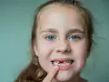 Wypadanie zębów mlecznych: Kiedy dentysta, a kiedy spokój rodzica?