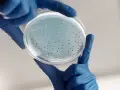 Badanie laboratoryjne wykazuje obecność drobnoustrojów, które mogą być przyczyną infekcji intymnej po antybiotyku.