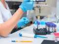 Laborantka w niebieskich rękawiczkach pobiera próbkę pipetą do probówki.