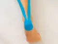 Blaues Kinesio-Tape stützt den Fuß und Unterschenkel, um Schmerzen zu lindern.