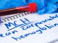 Probówka z krwią, notatnik z napisem "MCH mean corpuscular hemoglobin" i rękawiczki medyczne.