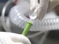 Hände in Handschuhen verbinden ein medizinisches Schlauchsystem. Mögliche Nachteile einer PEG-Sonde sind Infektionen und Verstopfungen.