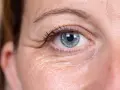 Nahaufnahme eines blauen Auges mit sichtbaren Lachfalten, die typisch für Frauen um die 40 sind.
