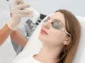 Zabieg z użyciem lasera w medycynie estetycznej. Pacjentka w okularach ochronnych poddaje się zabiegowi twarzy.